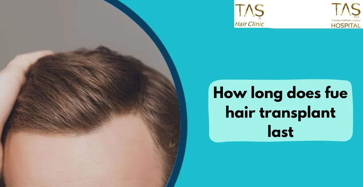 How long does fue hair transplant last